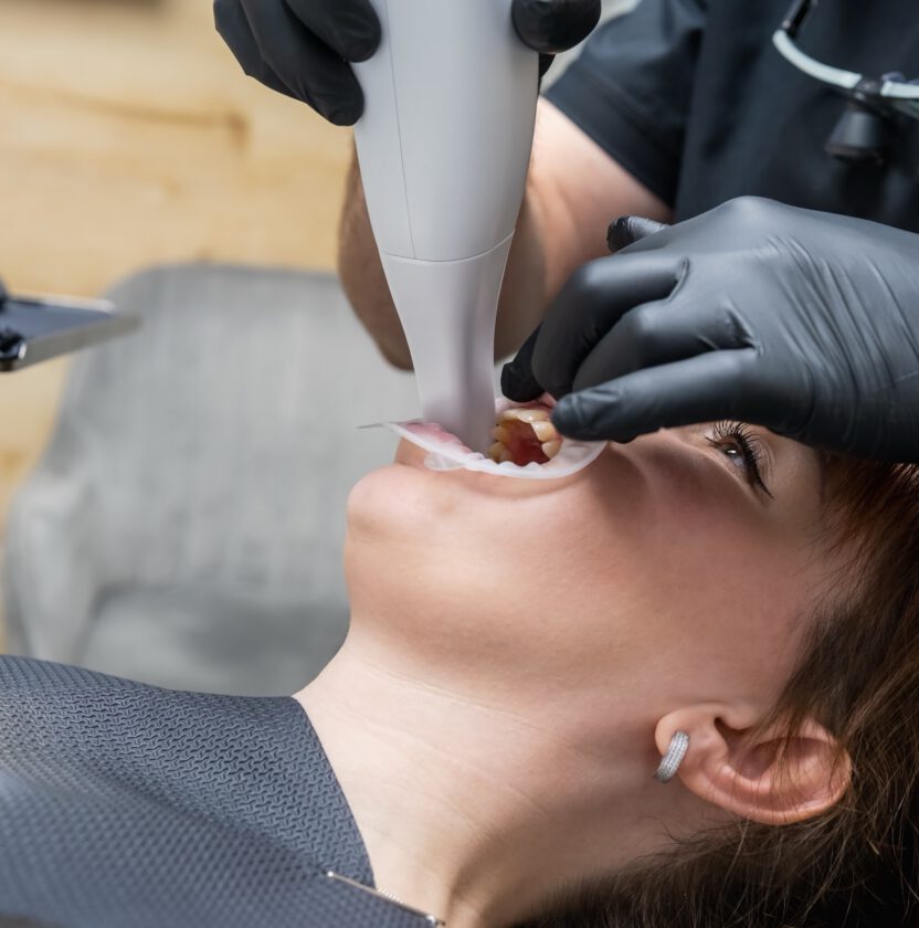 Close view of a handheld intraoral scanner being used in a patient's mouth