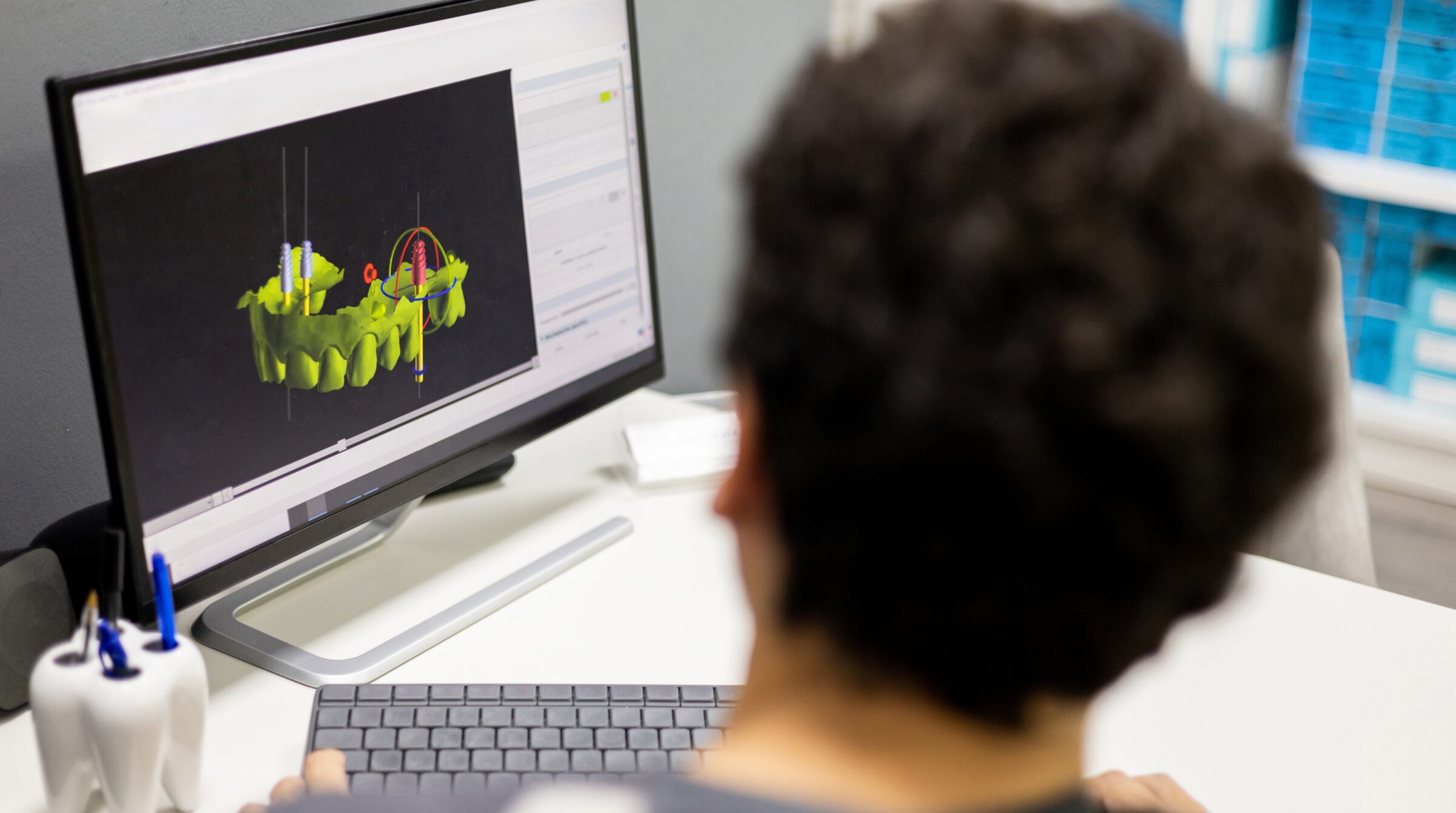 A clinician at a workstation planning dental implant positions on a three-dimensional model of the jaw (stock photograph, not the practice)