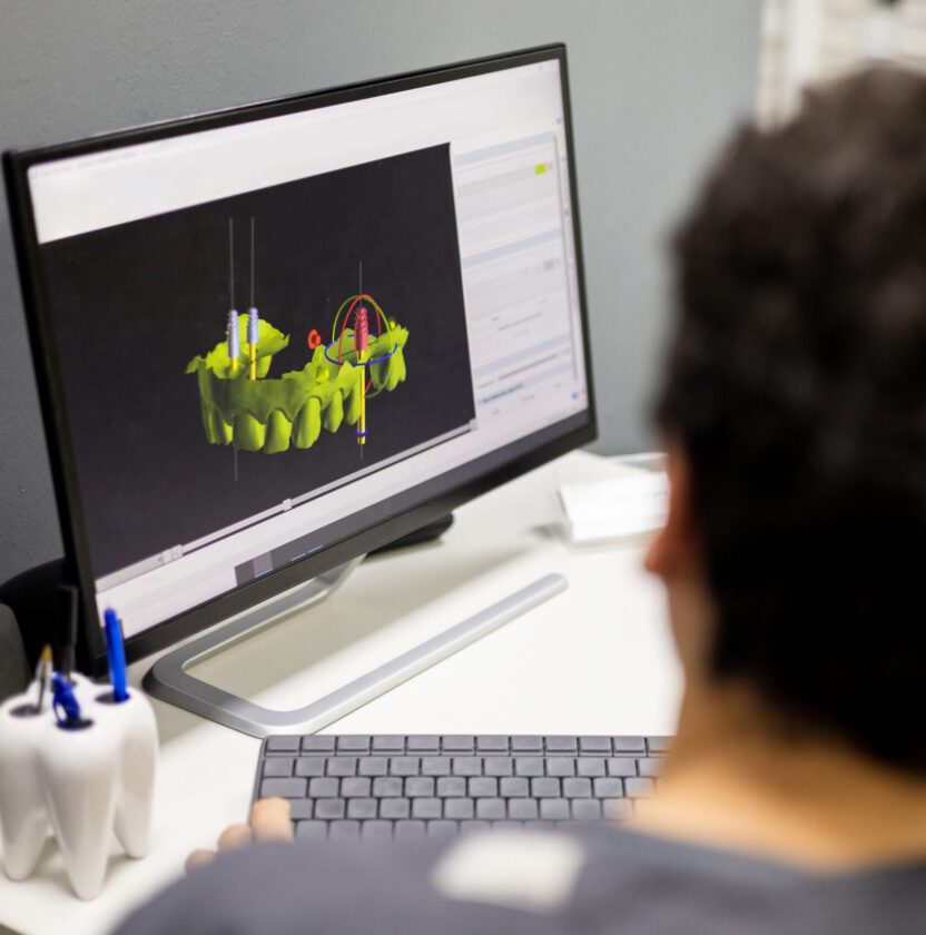 A clinician at a workstation planning dental implant positions on a three-dimensional model of the jaw (stock photograph, not the practice)