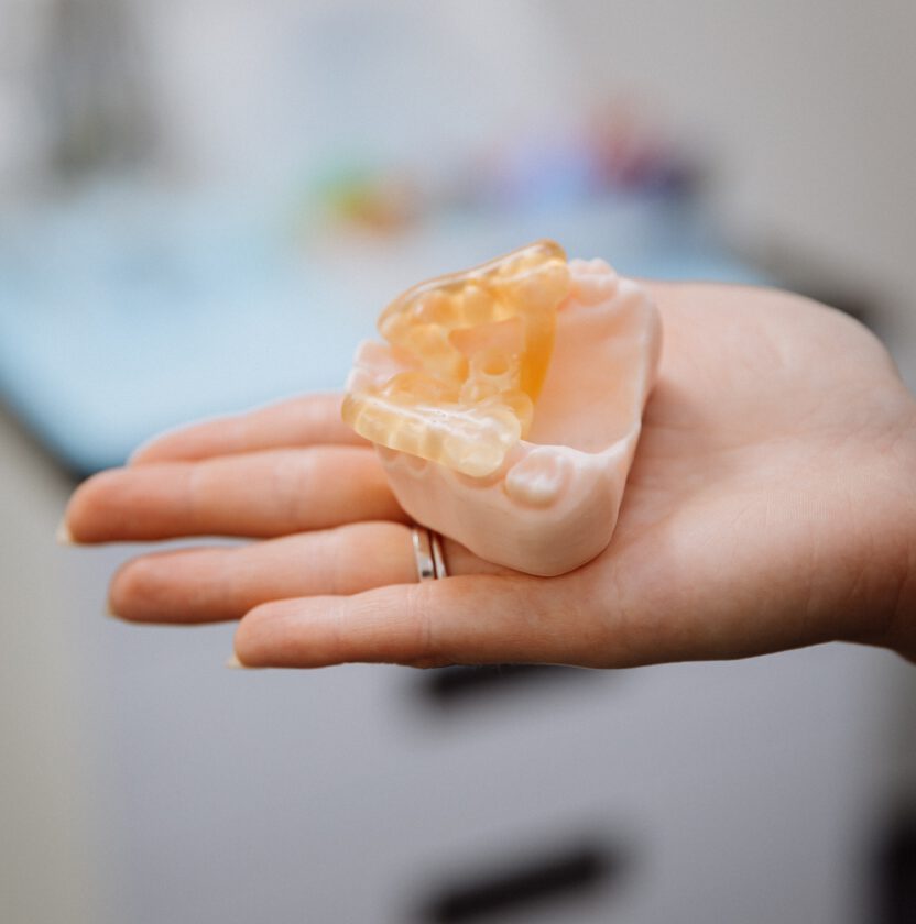 A 3D-printed implant surgical guide seated on a printed model of the teeth, held in a hand (stock photograph, not the practice)